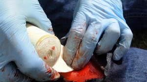 Image of combat gauze being inserted into wound