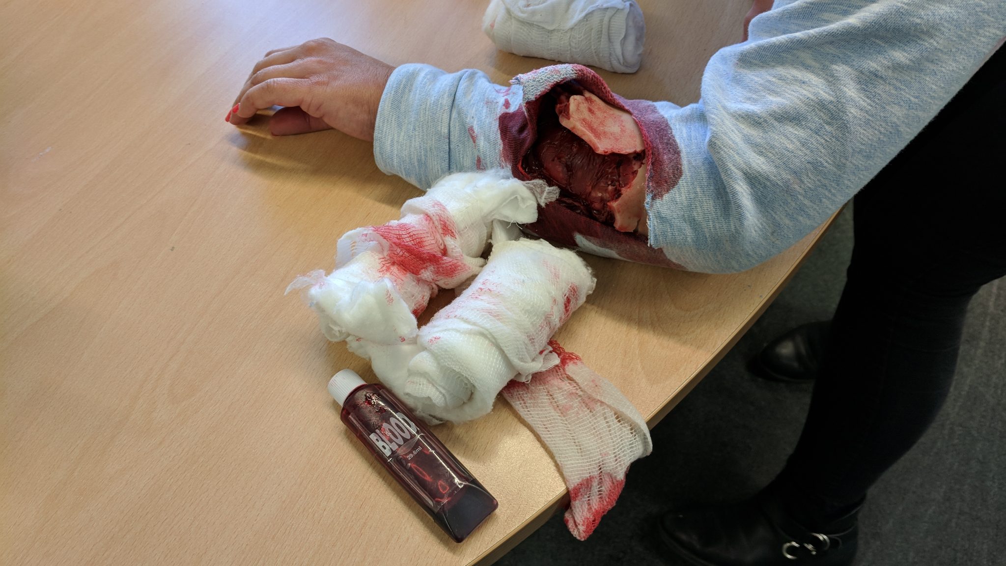 Simulated injury to the arm from our First Aid at Work course